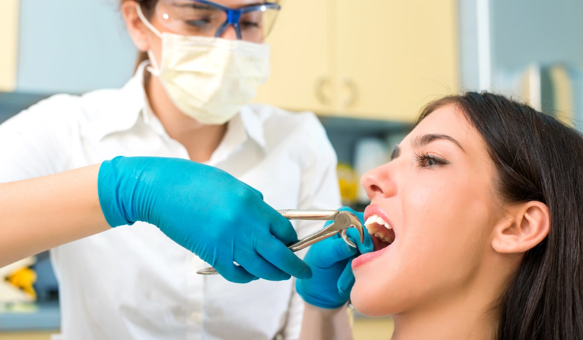 How much does Tooth extraction Cost